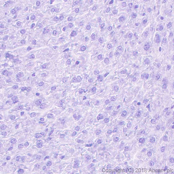Immunohistochemistry (Formalin/PFA-fixed paraffin-embedded sections) - Anti-LINE-1 ORF1p antibody [EPR21844-108] (AB216324)