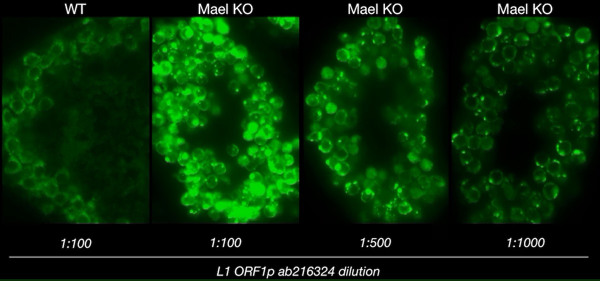 Immunohistochemistry (Frozen sections) - Anti-LINE-1 ORF1p antibody [EPR21844-108] (ab216324), expandable thumbnail