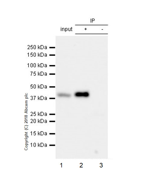 Immunoprecipitation - Anti-LINE-1 ORF1p antibody [EPR21844-108] (ab216324), expandable thumbnail