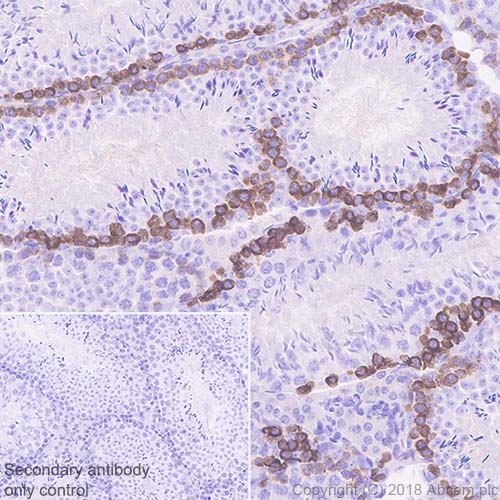 Immunohistochemistry (Formalin/PFA-fixed paraffin-embedded sections) - Anti-LINE-1 ORF1p antibody [EPR21844-108] - BSA and Azide free (AB245122)