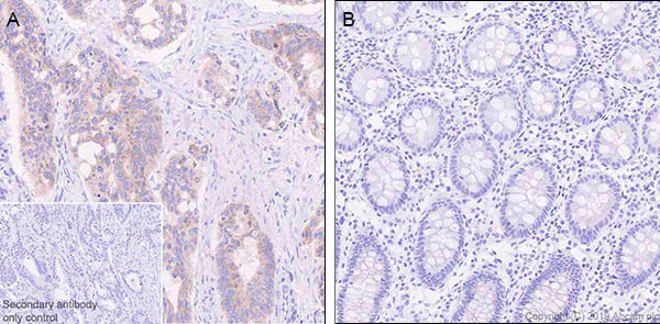 Immunohistochemistry (Formalin/PFA-fixed paraffin-embedded sections) - Anti-LINE-1 ORF1p antibody [EPR22227-54] - BSA and Azide free (AB246320)