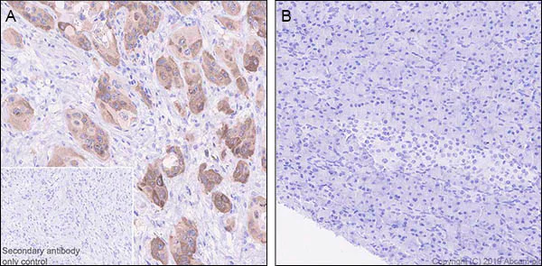 Immunohistochemistry (Formalin/PFA-fixed paraffin-embedded sections) - Anti-LINE-1 ORF1p antibody [EPR22227-54] - BSA and Azide free (AB246320)