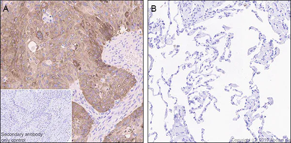 Immunohistochemistry (Formalin/PFA-fixed paraffin-embedded sections) - Anti-LINE-1 ORF1p antibody [EPR22227-54] - BSA and Azide free (AB246320)