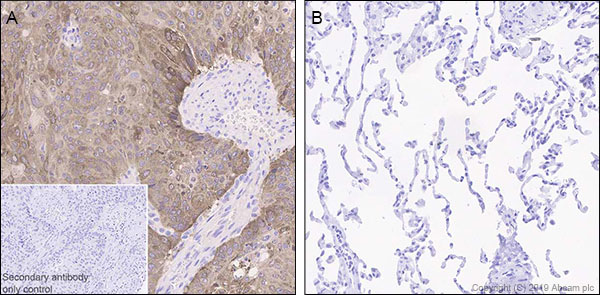 Immunohistochemistry (Formalin/PFA-fixed paraffin-embedded sections) - Anti-LINE-1 ORF1p antibody [EPR22227-6] (ab245249), expandable thumbnail