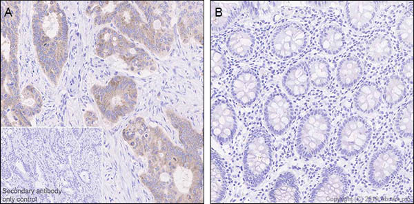 Immunohistochemistry (Formalin/PFA-fixed paraffin-embedded sections) - Anti-LINE-1 ORF1p antibody [EPR22227-6] (AB245249), expandable thumbnail