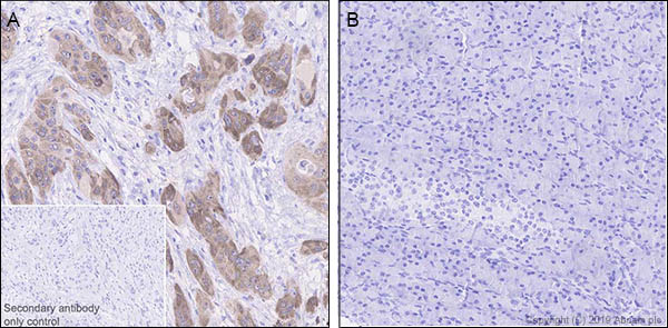 Immunohistochemistry (Formalin/PFA-fixed paraffin-embedded sections) - Anti-LINE-1 ORF1p antibody [EPR22227-6] (AB245249), expandable thumbnail