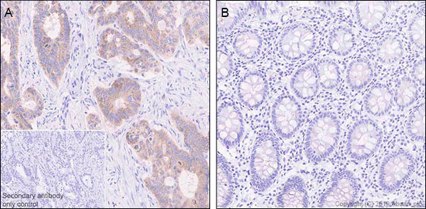 Immunohistochemistry (Formalin/PFA-fixed paraffin-embedded sections) - Anti-LINE-1 ORF1p antibody [EPR22227-6] - BSA and Azide free (AB246317)