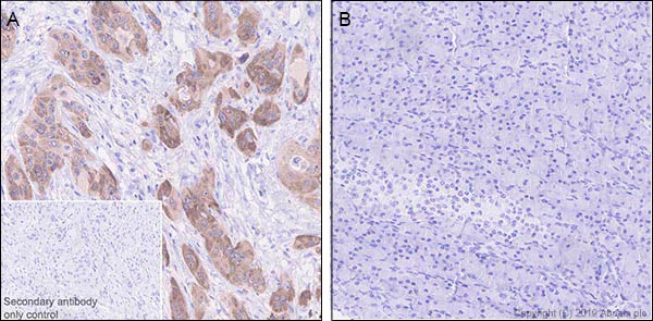 Immunohistochemistry (Formalin/PFA-fixed paraffin-embedded sections) - Anti-LINE-1 ORF1p antibody [EPR22227-6] - BSA and Azide free (AB246317)