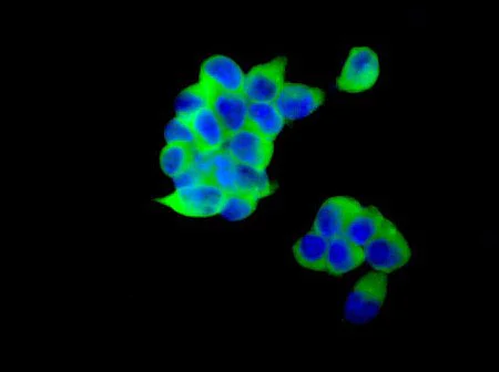 Immunocytochemistry/ Immunofluorescence - Anti-LINGO3 antibody [EPR9635] - BSA and Azide free (AB249518)