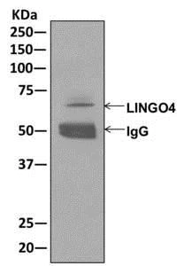 Immunoprecipitation - Anti-LINGO4 antibody [EPR12600] - BSA and Azide free (AB249823)