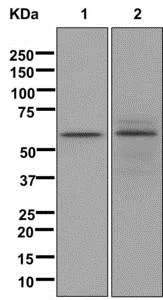 Western blot - Anti-LINGO4 antibody [EPR12600] - BSA and Azide free (AB249823)