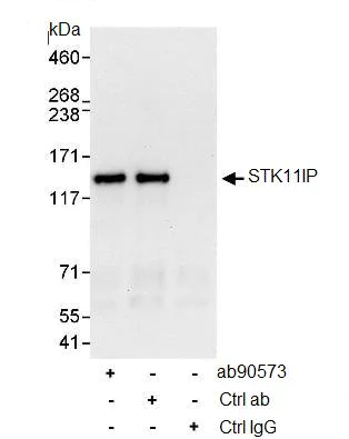 Immunoprecipitation - Anti-LIP1 antibody (AB90573)