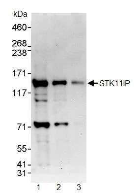 Western blot - Anti-LIP1 antibody (AB90573)