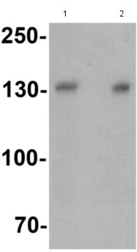 Western blot - Anti-LIPA3 antibody - C-terminal (AB180888)