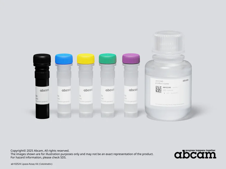 Schematic Diagram - Lipase Assay Kit (Colorimetric) (AB102524)