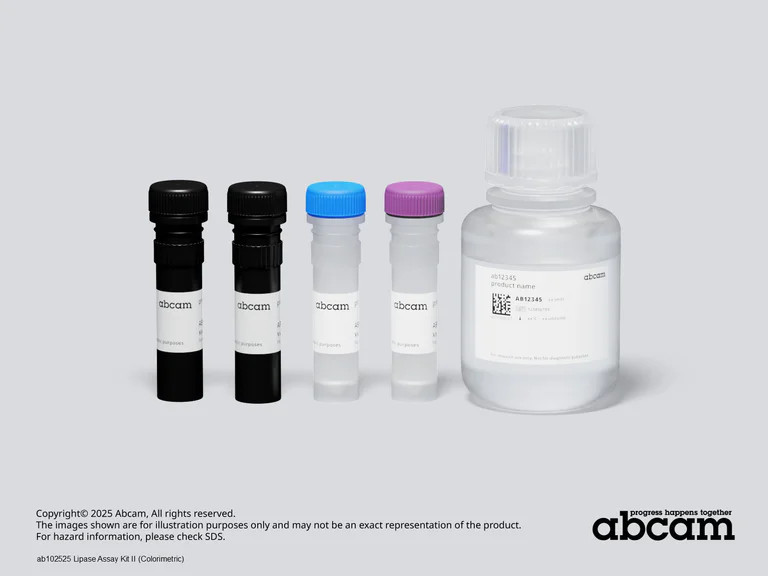 Other - Lipase Assay Kit II (Colorimetric) (AB102525)