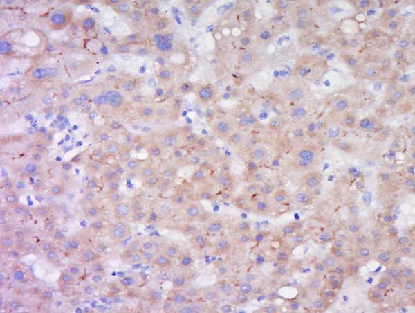 Immunohistochemistry (Formalin/PFA-fixed paraffin-embedded sections) - Anti-LIPC antibody (AB217360)