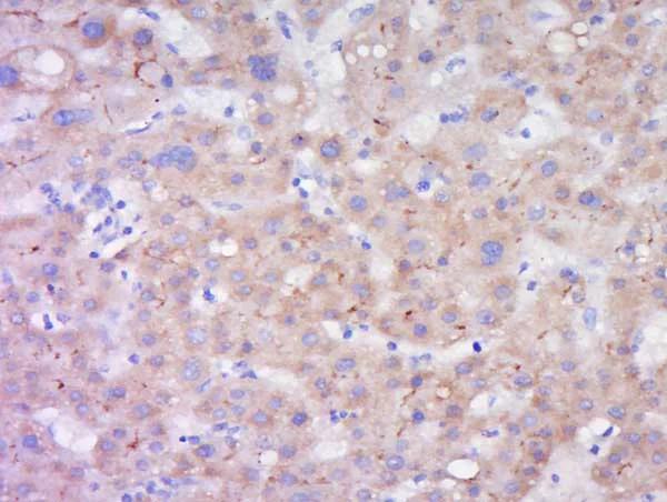 Immunohistochemistry (Formalin/PFA-fixed paraffin-embedded sections) - Anti-LIPC antibody (AB217360)