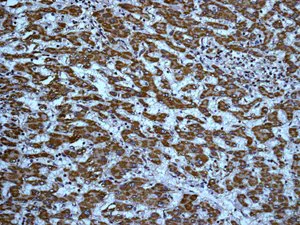 Immunohistochemistry (Formalin/PFA-fixed paraffin-embedded sections) - Anti-LIPF antibody [EPR5711(B)] (AB124831)