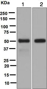 Western blot - Anti-LIPF antibody [EPR5711(B)] (AB124831)