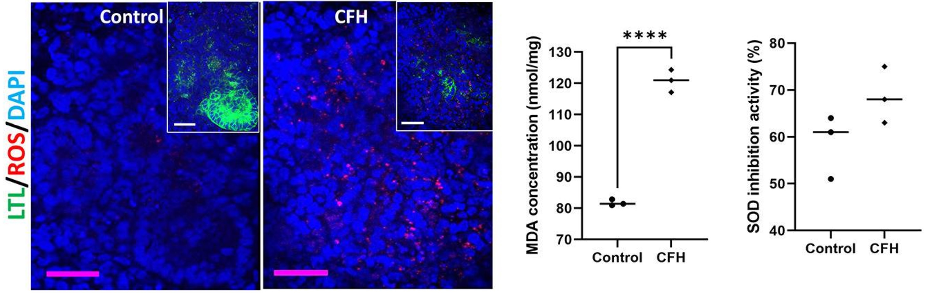 Biochemical assay - Lipid Peroxidation (MDA) Assay Kit (Colorimetric/Fluorometric) (ab118970), expandable thumbnail