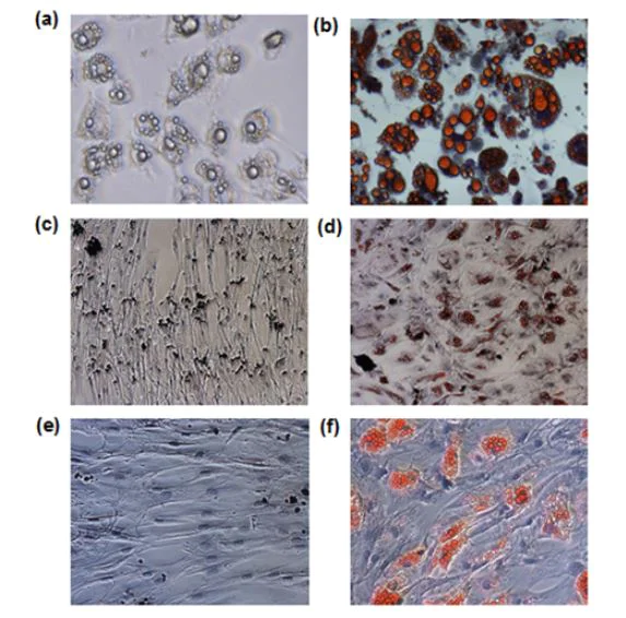 Staining - Lipid Staining Kit (AB287838)