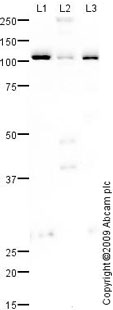 Western blot - Anti-Lipin 1 antibody (AB70138), expandable thumbnail