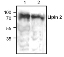Western blot - Anti-Lipin 2/LPIN2 antibody (AB63928)