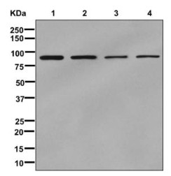 Western blot - Anti-Lipin 2/LPIN2 antibody [EPR12479] (AB176347), expandable thumbnail