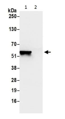 Immunoprecipitation - Anti-Lipoamide Dehydrogenase antibody - C-terminal (AB226202)