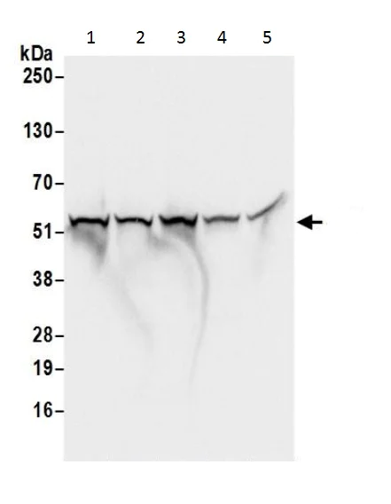 Western blot - Anti-Lipoamide Dehydrogenase antibody - C-terminal (AB226202)