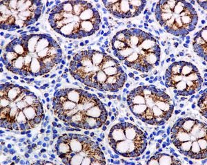 Immunohistochemistry (Formalin/PFA-fixed paraffin-embedded sections) - Anti-Lipoamide Dehydrogenase antibody [EPR6634(B)] (AB124926)