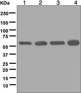 Western blot - Anti-Lipoamide Dehydrogenase antibody [EPR6634(B)] (AB124926)