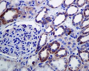 Immunohistochemistry (Formalin/PFA-fixed paraffin-embedded sections) - Anti-Lipoamide Dehydrogenase antibody [EPR6635] (AB133551)