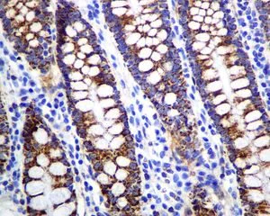 Immunohistochemistry (Formalin/PFA-fixed paraffin-embedded sections) - Anti-Lipoamide Dehydrogenase antibody [EPR6635] (AB133551)