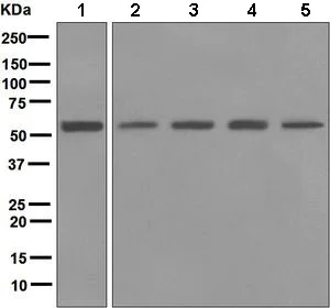 Western blot - Anti-Lipoamide Dehydrogenase antibody [EPR6635] (AB133551)