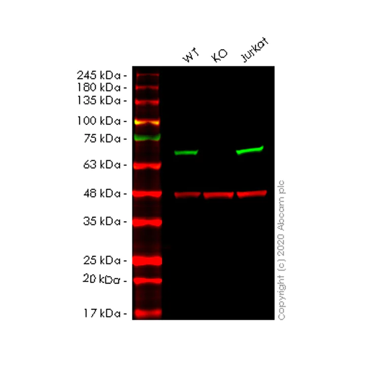 Western blot - Anti-Lipoamide Dehydrogenase antibody [EPR6635] (AB133551)