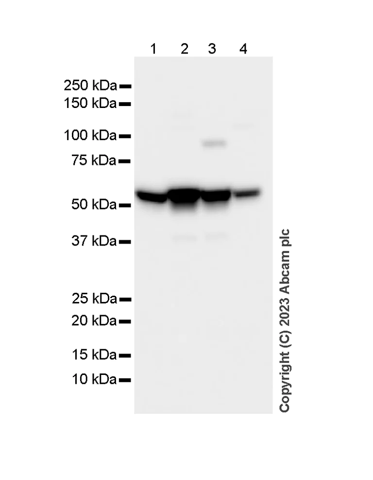 Western blot - Anti-Lipoamide Dehydrogenase antibody [EPR6635] (AB133551)