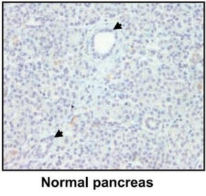 Immunohistochemistry (Formalin/PFA-fixed paraffin-embedded sections) - Anti-Lipocalin-2 / NGAL antibody [5G5] (AB23477), expandable thumbnail