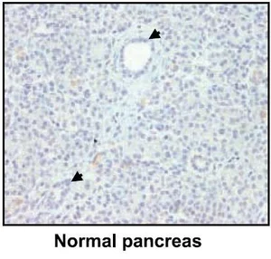 Immunohistochemistry (Formalin/PFA-fixed paraffin-embedded sections) - Anti-Lipocalin-2 / NGAL antibody [5G5] (AB23477)