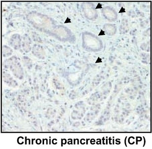 Immunohistochemistry (Formalin/PFA-fixed paraffin-embedded sections) - Anti-Lipocalin-2 / NGAL antibody [5G5] (AB23477), expandable thumbnail