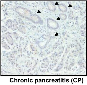 Immunohistochemistry (Formalin/PFA-fixed paraffin-embedded sections) - Anti-Lipocalin-2 / NGAL antibody [5G5] (AB23477)