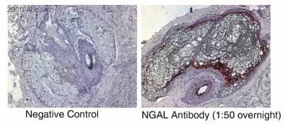 Immunohistochemistry (Formalin/PFA-fixed paraffin-embedded sections) - Anti-Lipocalin-2 / NGAL antibody [5G5] (AB23477), expandable thumbnail