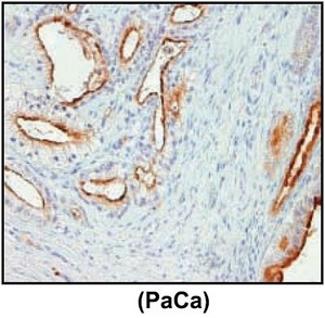 Immunohistochemistry (Formalin/PFA-fixed paraffin-embedded sections) - Anti-Lipocalin-2 / NGAL antibody [5G5] (AB23477), expandable thumbnail