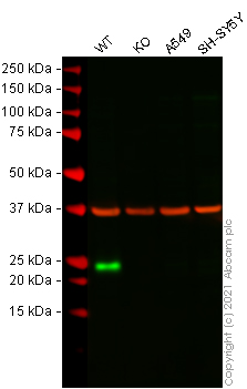 Western blot - Anti-Lipocalin-2 / NGAL antibody [5G5] (AB23477), expandable thumbnail