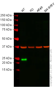 Western blot - Anti-Lipocalin-2 / NGAL antibody [5G5] (AB23477)