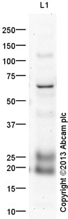 Western blot - Anti-Lipocalin-2 / NGAL antibody (AB41105), expandable thumbnail