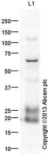 Western blot - Anti-Lipocalin-2 / NGAL antibody (AB41105)