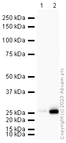 Western blot - Anti-Lipocalin-2 / NGAL antibody (AB63929)