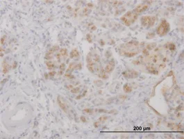 Immunohistochemistry (Formalin/PFA-fixed paraffin-embedded sections) - Anti-Lipocalin-2 / NGAL antibody (AB89819)